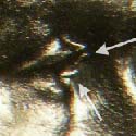 Pre-attribution image for 1943S•1DO•006