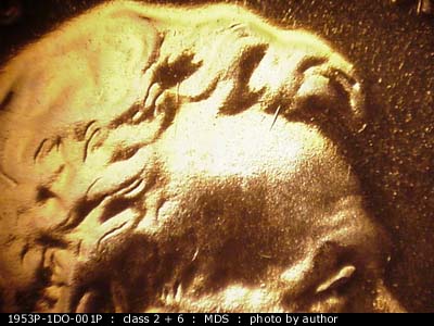 Die-stage B marker on 1953P•1DO•001P showing A number of small die scratches and gouges show where the hair meets the forehead.