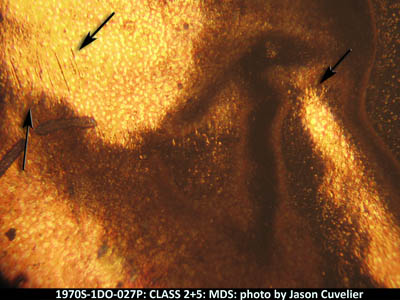 Die-stage B marker on 1970S•1DO•027P (1970 Doubled Die Obverse).