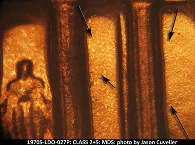 Die-stage B marker on 1970S•1DO•027P (1970 Doubled Die Obverse).